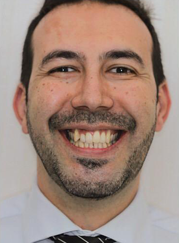 Dr. Charles Alencar - Invisalign Ortodontia Aparelho invisível